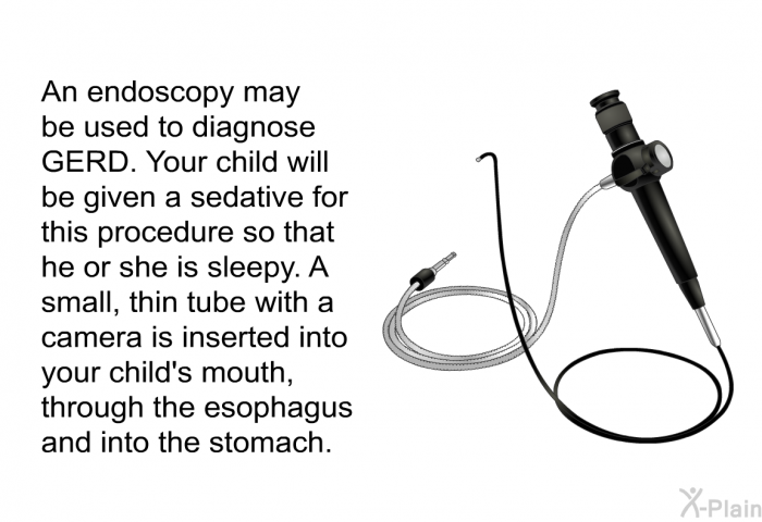 An endoscopy may be used to diagnose GERD. Your child will be given a sedative for this procedure so that he or she is sleepy. A small, thin tube with a camera is inserted into your child's mouth, through the esophagus and into the stomach.