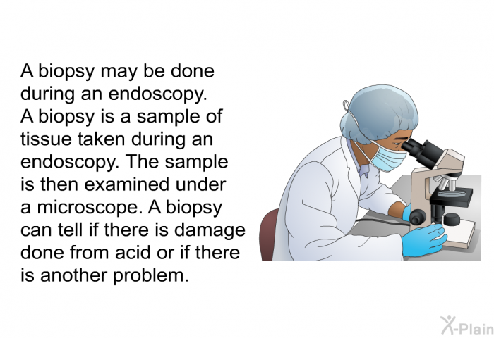 A biopsy may be done during an endoscopy. A biopsy is a sample of tissue taken during an endoscopy. The sample is then examined under a microscope. A biopsy can tell if there is damage done from acid or if there is another problem.