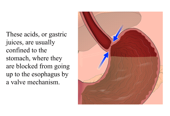 These acids, or gastric juices, are usually confined to the stomach, where they are blocked from going up to the esophagus by a valve mechanism.