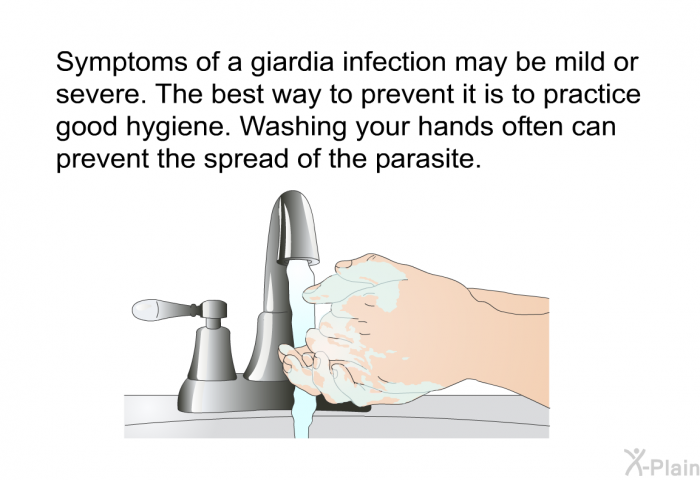 Symptoms of a giardia infection may be mild or severe. The best way to prevent it is to practice good hygiene. Washing your hands often can prevent the spread of the parasite.
