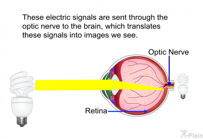 These electric signals are sent through the optic nerve to the brain, which translates these signals into images we see.