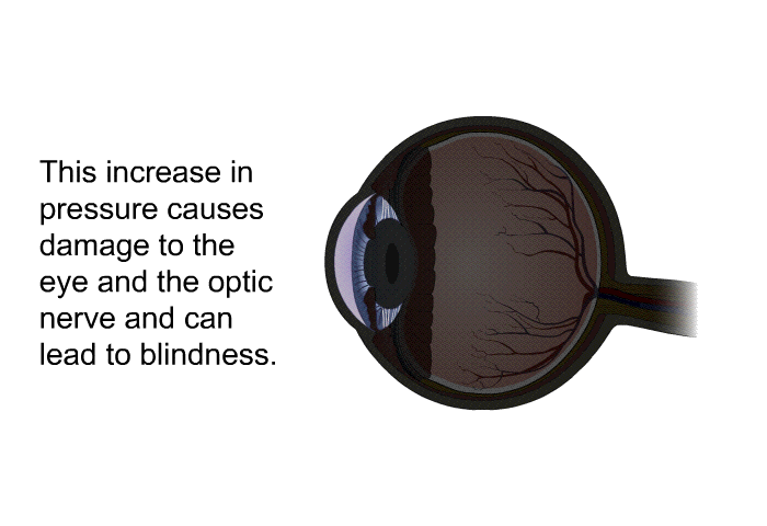 If the fluid is not reabsorbed at the same speed that it is formed, it builds up in the anterior chamber. When fluid builds up, pressure and tension inside the eye increases.