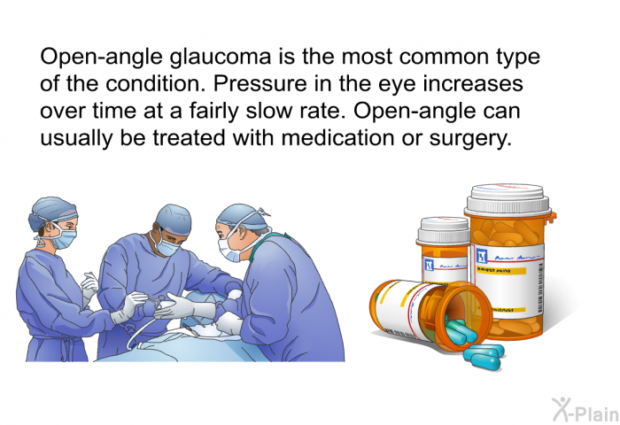 Open-angle glaucoma is the most common type of the condition. Pressure in the eye increases over time at a fairly slow rate. Open-angle can usually be treated with medication or surgery.
