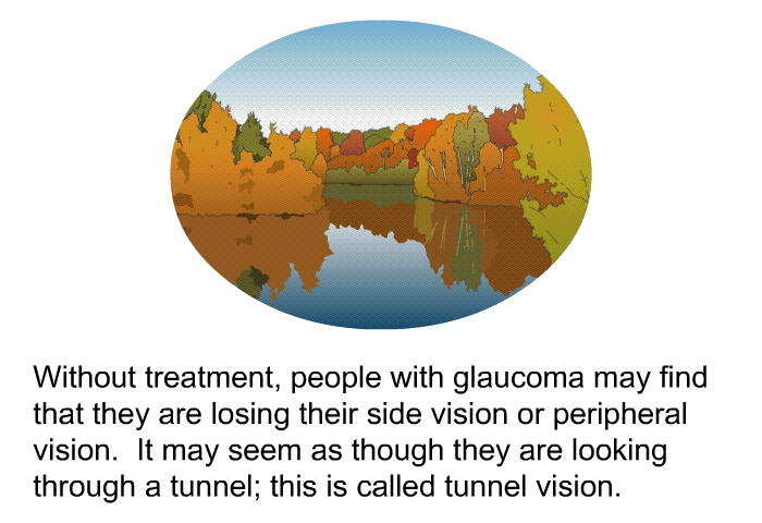 Without treatment, people with glaucoma may find that they are losing their side vision or peripheral vision. It may seem as though they are looking through a tunnel; this is called tunnel vision.