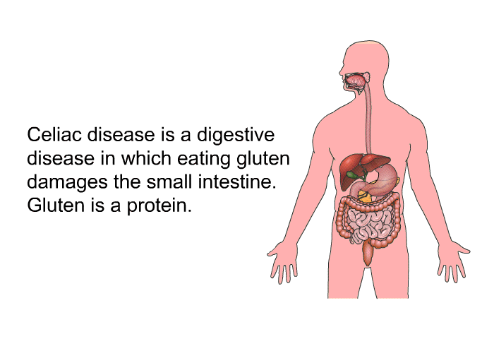 Celiac disease is a digestive disease in which eating gluten damages the small intestine. Gluten is a protein.