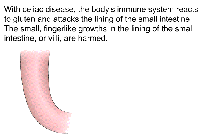 With celiac disease, the body's immune system reacts to gluten and attacks the lining of the small intestine. The small, fingerlike growths in the lining of the small intestine, or villi, are harmed.