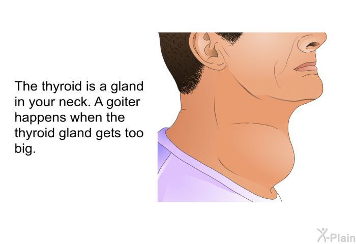 The thyroid is a gland in your neck. A goiter happens when the thyroid gland gets too big.