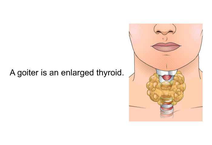 A goiter is an enlarged thyroid.