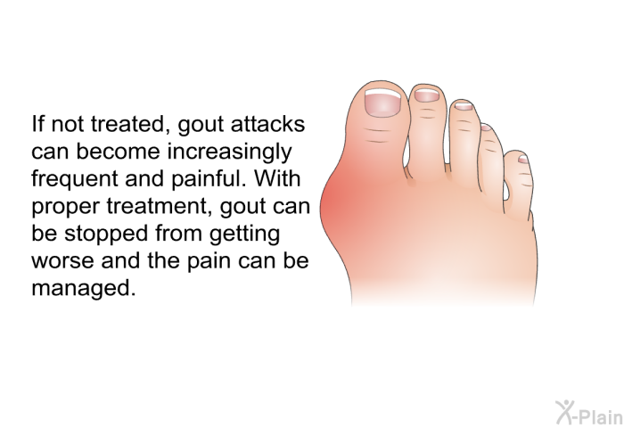If not treated, gout attacks can become increasingly frequent and painful. With proper treatment, gout can be stopped from getting worse and the pain can be managed.