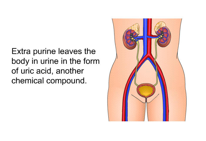 Extra purine leaves the body in urine in the form of uric acid, another chemical compound.