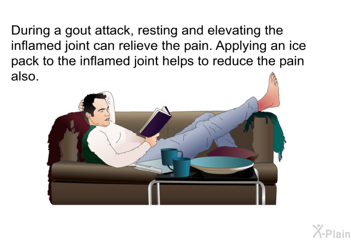 During a gout attack, resting and elevating the inflamed joint can relieve the pain. Applying an ice pack to the inflamed joint helps to reduce the pain also.