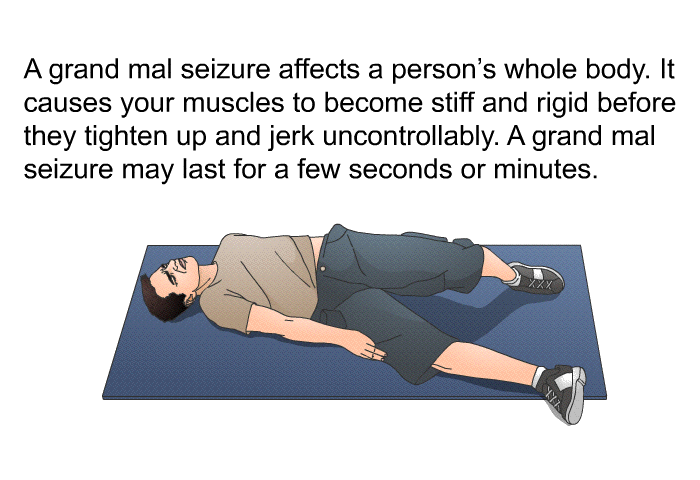 A grand mal seizure affects a person's whole body. It causes your muscles to become stiff and rigid before they tighten up and jerk uncontrollably. A grand mal seizure may last for a few seconds or minutes.