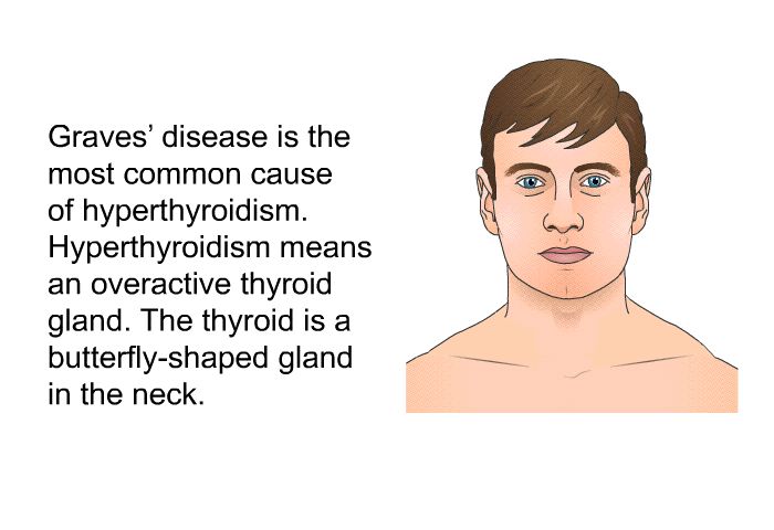 Graves' disease is the most common cause of hyperthyroidism. Hyperthyroidism means an overactive thyroid gland. The thyroid is a butterfly-shaped gland in the neck.