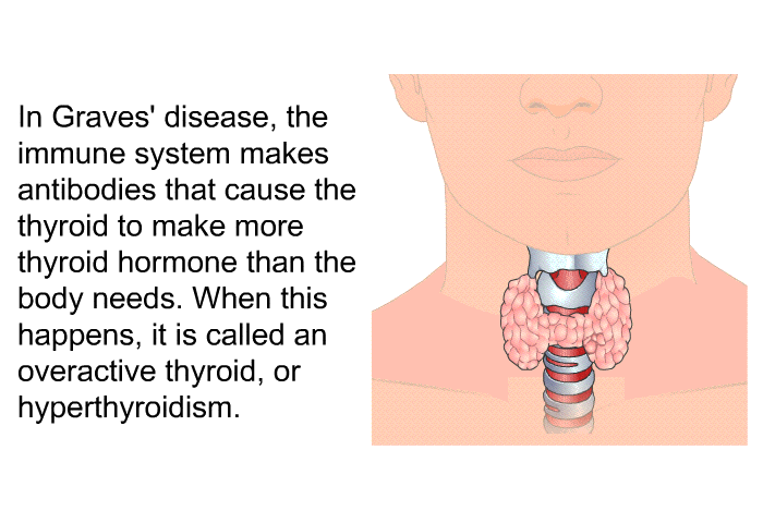In Graves' disease, the immune system makes antibodies that cause the thyroid to make more thyroid hormone than the body needs. When this happens, it is called an overactive thyroid, or hyperthyroidism.