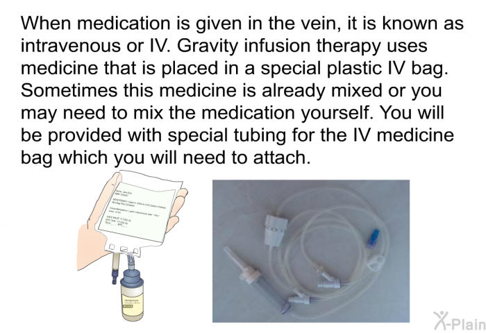 When medication is given in the vein, it is known as intravenous or IV. Gravity Infusion therapy uses medicine that is placed in a special plastic IV bag. Sometimes this medicine is already mixed or you may need to mix the medication yourself. You will be provided with special tubing for the IV medicine bag which you will need to attach.