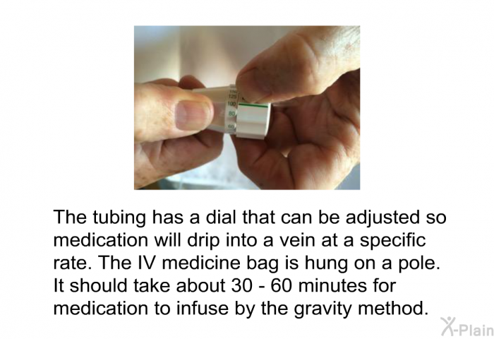 The tubing has a dial that can be adjusted so medication will drip into a vein at a specific rate. The IV medicine bag is hung on a pole. It should take about 30 - 60 minutes for medication to infuse by the gravity method.