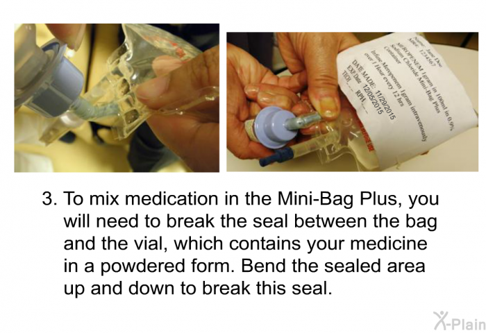 To mix medication in the Mini-Bag Plus, you will need to break the seal between the bag and the vial, which contains your medicine in a powdered form. Bend the sealed area up and down to break this seal.