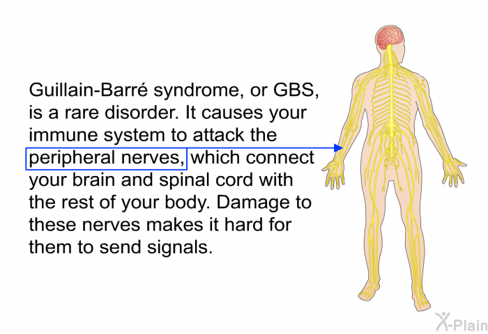 Guillain-Barr syndrome, or GBS, is a rare disorder. It causes your immune system to attack the peripheral nerves, which connect your brain and spinal cord with the rest of your body. Damage to these nerves makes it hard for them to send signals.