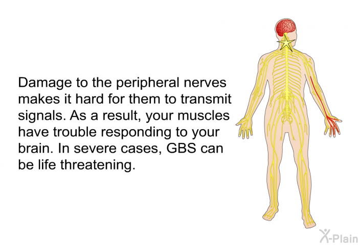 Damage to the peripheral nerves makes it hard for them to transmit signals. As a result, your muscles have trouble responding to your brain. In severe cases, GBS can be life threatening.