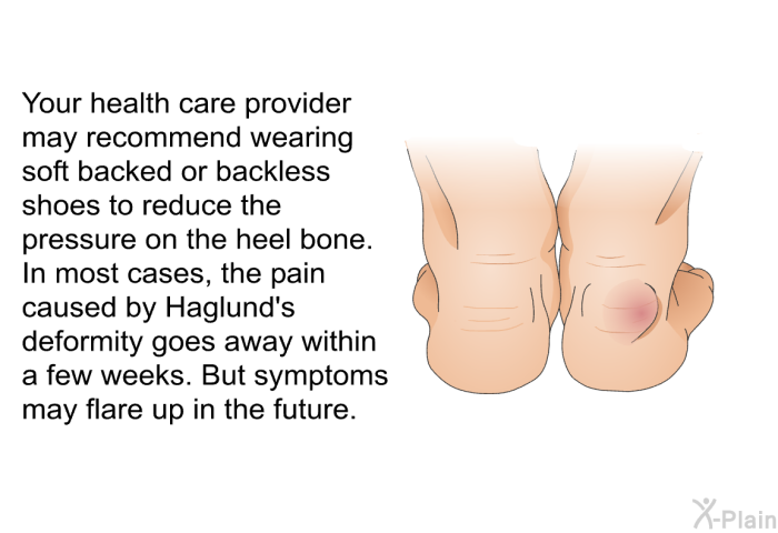 Your health care provider may recommend wearing soft backed or backless shoes to reduce the pressure on the heel bone. In most cases, the pain caused by Haglund's deformity goes away within a few weeks. But symptoms may flare up in the future.