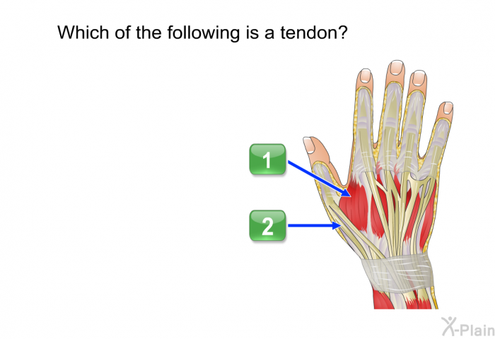 Which of the following is a tendon?