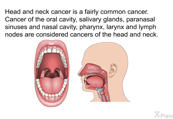 Head and neck cancer is a fairly common cancer. Cancer of the oral cavity, salivary glands, paranasal sinuses and nasal cavity, pharynx, larynx and lymph nodes are considered cancers of the head and neck.