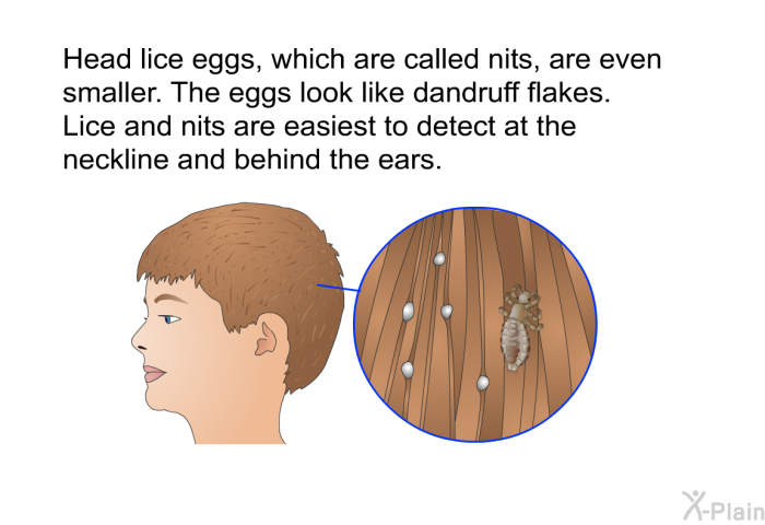 Head lice eggs, which are called nits, are even smaller. The eggs look like dandruff flakes. Lice and nits are easiest to detect at the neckline and behind the ears.