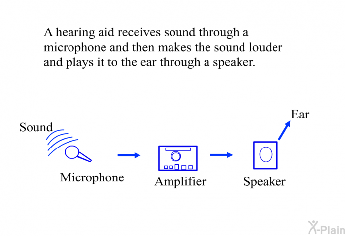 A hearing aid receives sound through a microphone and then makes the sound louder and plays it to the ear through a speaker.