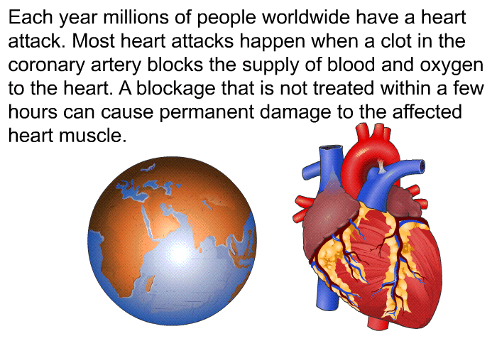Each year millions of people worldwide have a heart attack. Most heart attacks happen when a clot in the coronary artery blocks the supply of blood and oxygen to the heart. A blockage that is not treated within a few hours can cause permanent damage to the affected heart muscle.