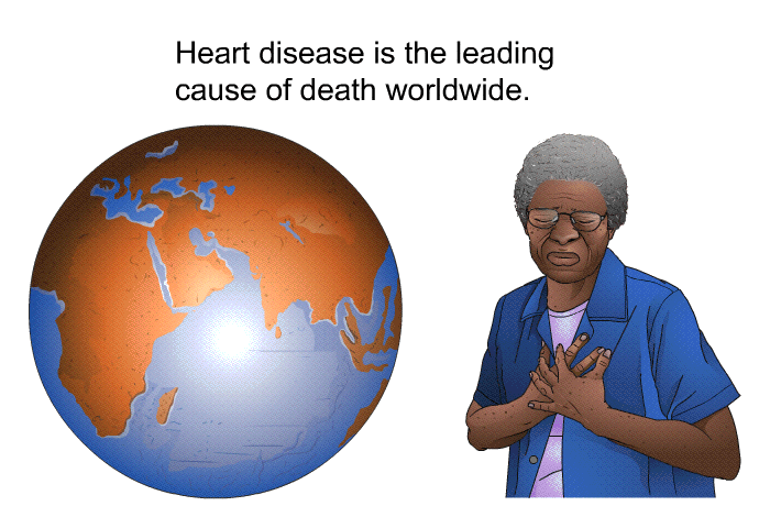 Heart disease is the leading cause of death worldwide.