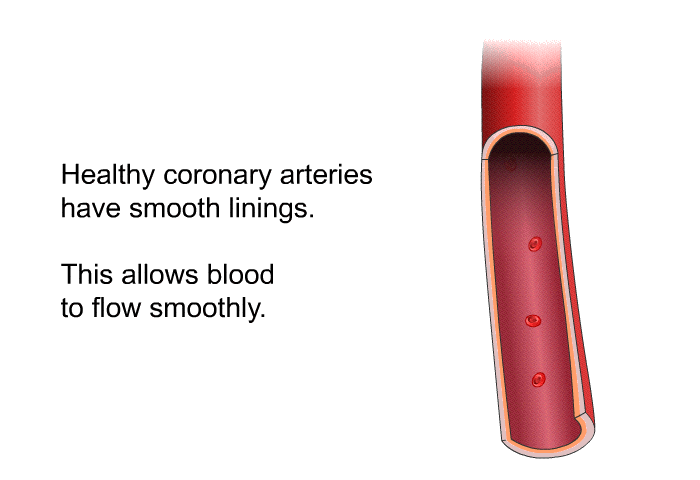 Healthy coronary arteries have smooth linings. This allows blood to flow smoothly.