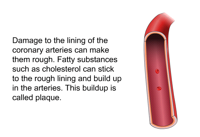 Damage to the lining of the coronary arteries can make them rough. Fatty substances such as cholesterol can stick to the rough lining and build up in the arteries. This buildup is called plaque.