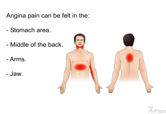 Angina pain can be felt in the:  Stomach area. Middle of the back. Arms. Jaw.
