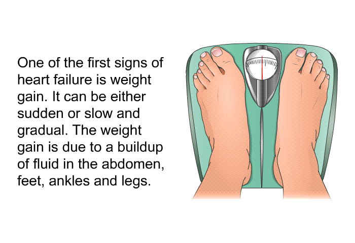 One of the first signs of heart failure is weight gain. It can be either sudden or slow and gradual. The weight gain is due to a buildup of fluid in the abdomen, feet, ankles and legs.