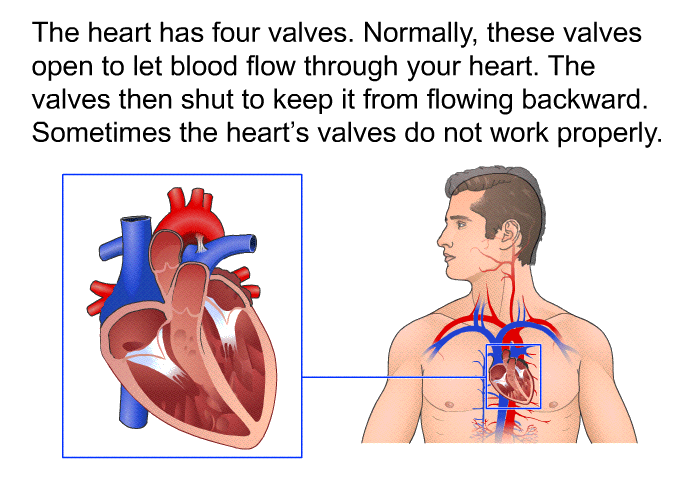PatEdu Heart Valve Diseases