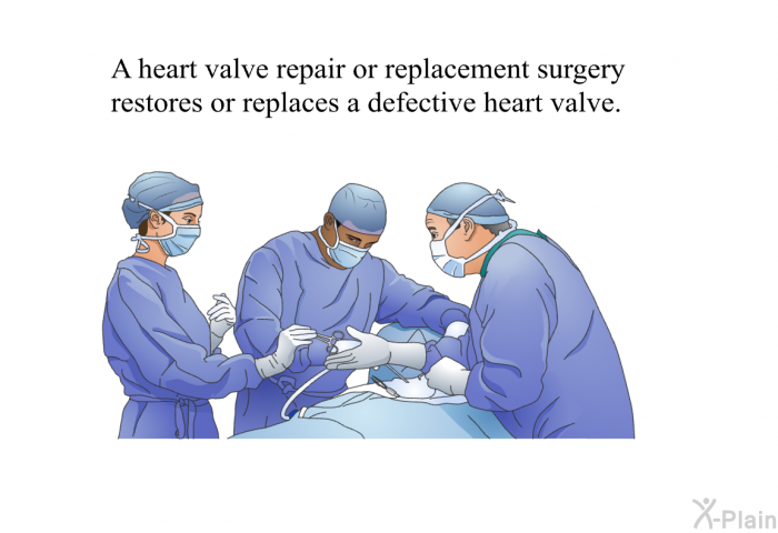 A heart valve repair or replacement surgery restores or replaces a defective heart valve.