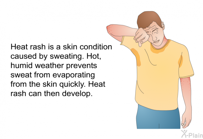 Heat rash is a skin condition caused by sweating. Hot, humid weather prevents sweat from evaporating from the skin quickly. Heat rash can then develop.