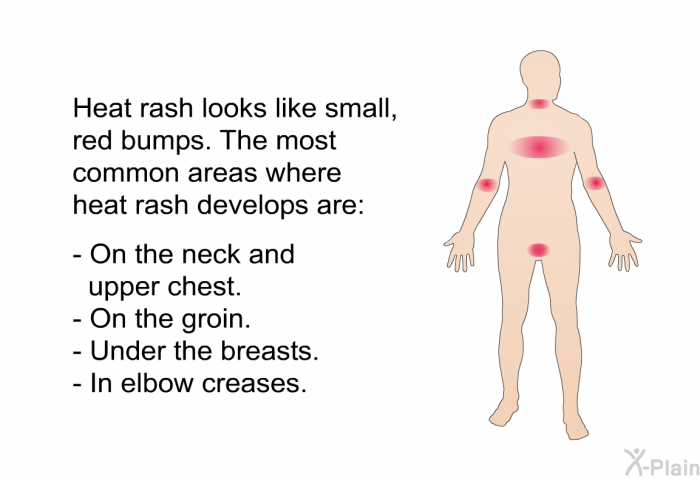 Heat rash looks like small, red bumps. The most common areas where heat rash develops are:  On the neck and upper chest. On the groin. Under the breasts. In elbow creases.
