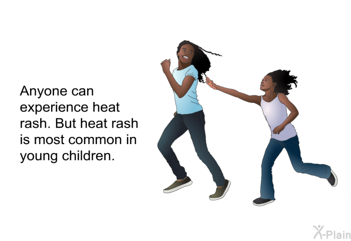Anyone can experience heat rash. But heat rash is most common in young children.