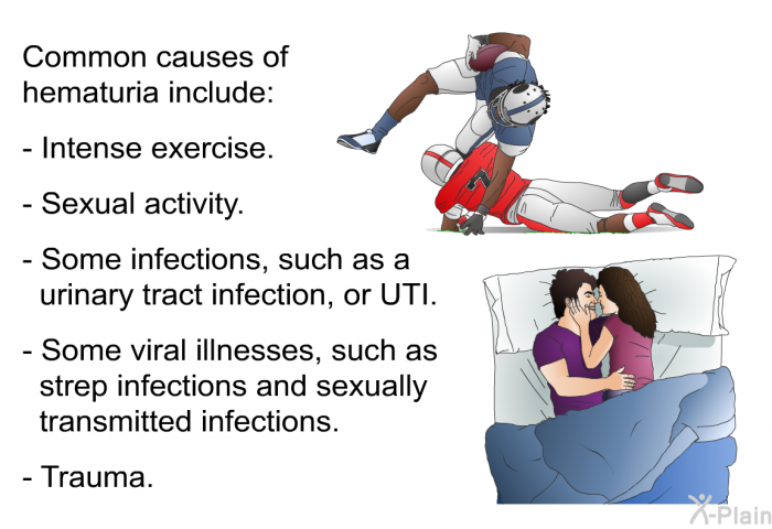 Common causes of hematuria include:  Intense exercise. Sexual activity. Some infections, such as a urinary tract infection, or UTI. Some viral illnesses, such as strep infections and sexually transmitted infections. Trauma.