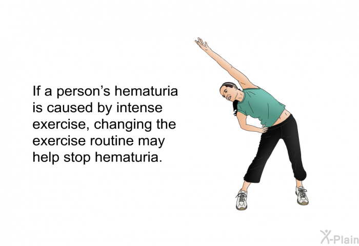 If a person's hematuria is caused by intense exercise, changing the exercise routine may help stop hematuria.