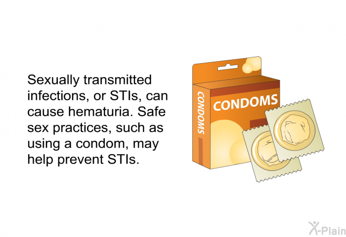 Sexually transmitted infections, or STIs, can cause hematuria. Safe sex practices, such as using a condom, may help prevent STIs.
