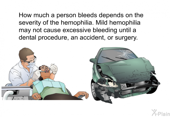 How much a person bleeds depends on the severity of the hemophilia. Mild hemophilia may not cause excessive bleeding until a dental procedure, an accident, or surgery.