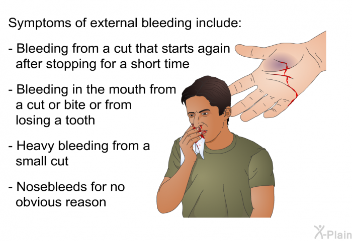 Symptoms of external bleeding include:  Bleeding from a cut that starts again after stopping for a short time Bleeding in the mouth from a cut or bite or from losing a tooth Heavy bleeding from a small cut Nosebleeds for no obvious reason