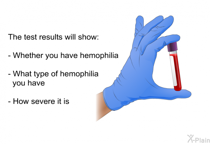 The test results will show:  Whether you have hemophilia What type of hemophilia you have How severe it is