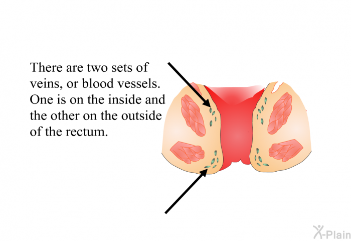 There are two sets of veins, or blood vessels. One is on the inside and the other on the outside of the rectum.