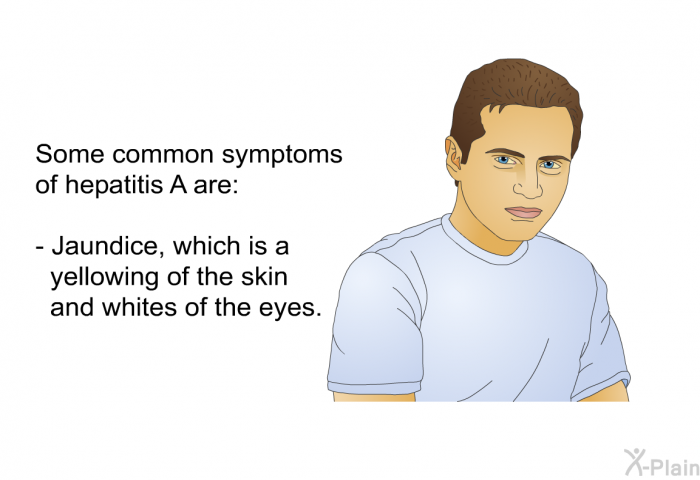 Some common symptoms of hepatitis A are:  Jaundice, which is a yellowing of the skin and whites of the eyes.