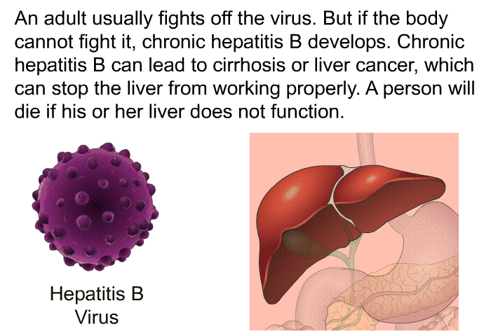 An adult usually fights off the virus. But if the body cannot fight it, chronic hepatitis B develops. Chronic hepatitis B can lead to cirrhosis or liver cancer, which can stop the liver from working properly. A person will die if his or her liver does not function.