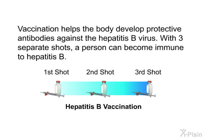 Vaccination helps the body develop protective antibodies against the hepatitis B virus. With 3 separate shots, a person can become immune to hepatitis B.