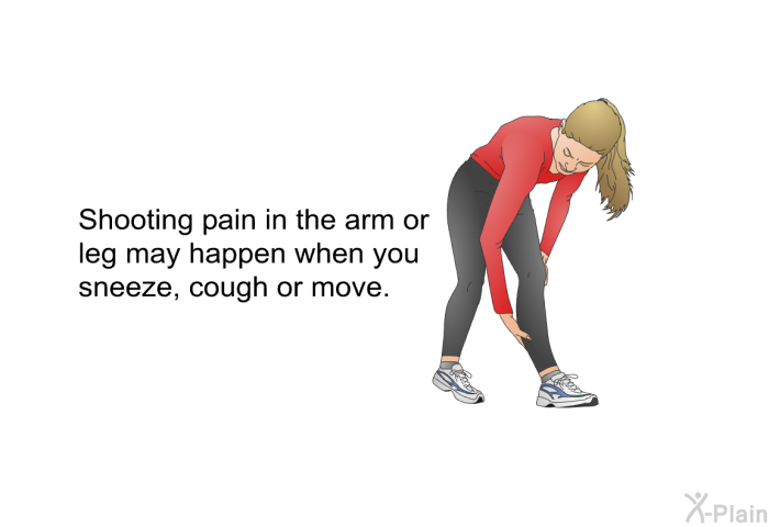 Shooting pain in the arm or leg may happen when you sneeze, cough or move.